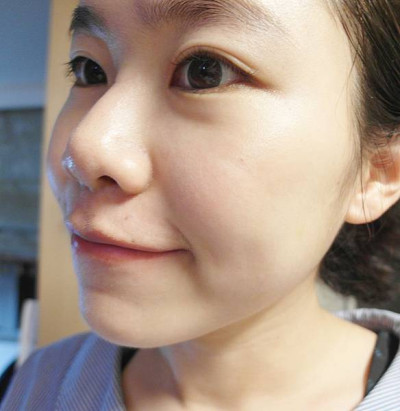 [分享] 夏日控油,痘痘粉刺肌使用的金盞花晶煥球精華使用心得,毛孔激進0