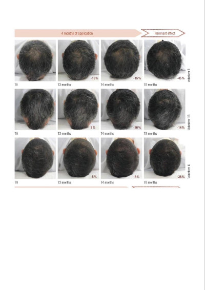 [分享]黑髮精華心得文