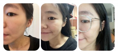 [分享]甘醇酸皮秒煥白液心得分享