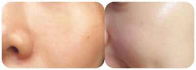 [分享] 肌膚改造計畫