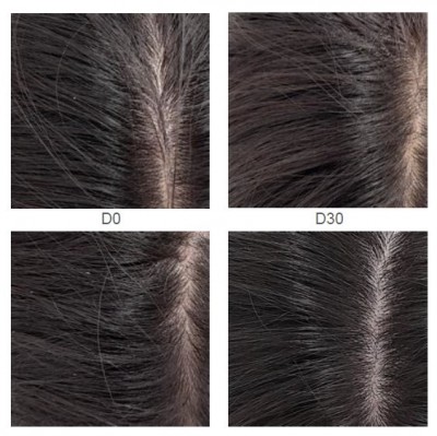 [心得]豐盈頭皮精華心得