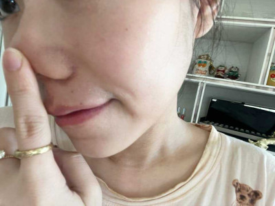 [分享] 重虐版本藻針霜加強版使用