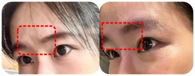 [分享] 小臉無痕定型胜肽原液心得分享