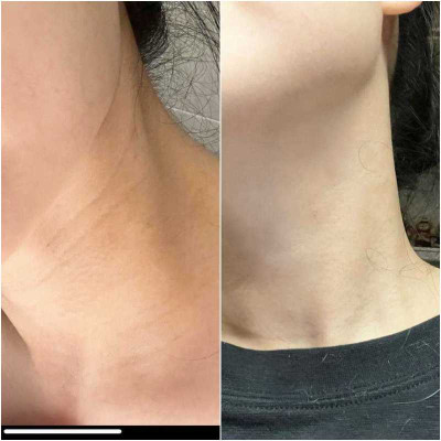 [心得]植萃桃香胜肽脖紋油心得文