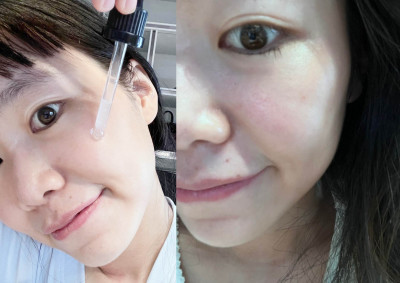 [分享] 分子酶白藻針精華