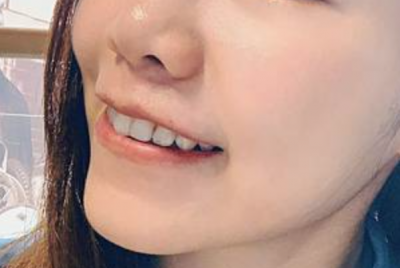 「分享」 胜肽牙膏使用心得！