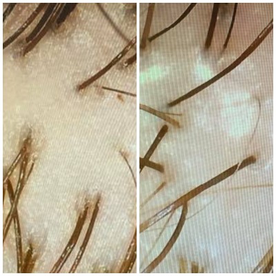 [分享] 頭皮精華凝膠分享