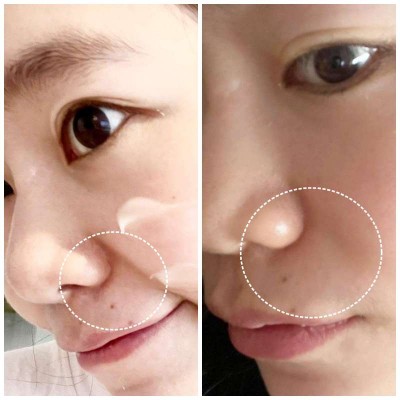 [心得]杏仁花酸水凝膜心得分享